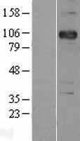 P cadherin(CDH3) (NM_001793) Human Tagged ORF Clone