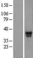 PDX1 (NM_000209) Human Tagged ORF Clone