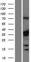 hnRNP A1(HNRNPA1) (NM_031157) Human Tagged ORF Clone
