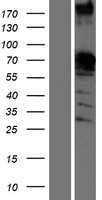 SAM68(KHDRBS1) (NM_006559) Human Tagged ORF Clone