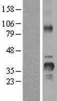 Cyclin D2(CCND2) (NM_001759) Human Tagged ORF Clone