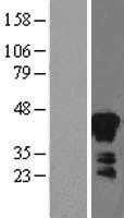 Zinc Alpha 2 Glycoprotein(AZGP1) (NM_001185) Human Tagged ORF Clone