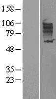 SLC26A3 (NM_000111) Human Tagged ORF Clone