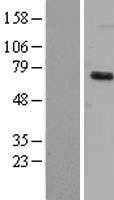 DYRK1B (NM_004714) Human Tagged ORF Clone