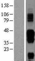 CD272(BTLA) (NM_181780) Human Tagged ORF Clone