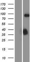 DCAMKL1(DCLK1) (NM_004734) Human Tagged ORF Clone