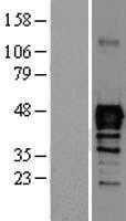 nkx6.1(NKX6) (NM_006168) Human Tagged ORF Clone