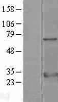 14-3-3 zeta(YWHAZ) (NM_001135702) Human Tagged ORF Clone