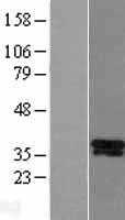 DLX5 (NM_005221) Human Tagged ORF Clone