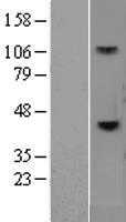 CD38 (NM_001775) Human Tagged ORF Clone