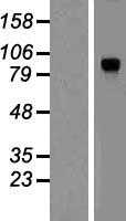 DYRK1A (NM_130436) Human Tagged ORF Clone