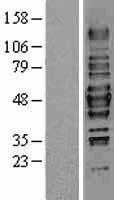 HDAC3 (NM_003883) Human Tagged ORF Clone