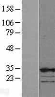 CBX7 (NM_175709) Human Tagged ORF Clone