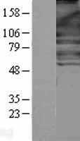 NFkB p100 / p52(NFKB2) (NM_002502) Human Tagged ORF Clone