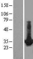 HDGF (NM_004494) Human Tagged ORF Clone