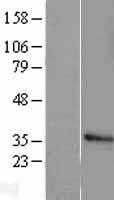 Histone H1.2(HIST1H1C) (NM_005319) Human Tagged ORF Clone