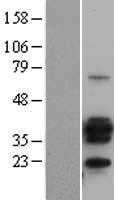 CD20(MS4A1) (NM_021950) Human Tagged ORF Clone