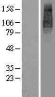 UNC93B(UNC93B1) (NM_030930) Human Tagged ORF Clone