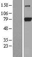 DRP1(DNM1L) (NM_012063) Human Tagged ORF Clone