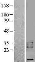 BAMBI (NM_012342) Human Tagged ORF Clone