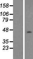 NAP1L1 (NM_139207) Human Tagged ORF Clone
