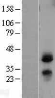 CD82 (NM_002231) Human Tagged ORF Clone