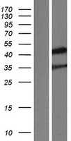 NR2E1(NR2E1) (NM_003269) Human Tagged ORF Clone