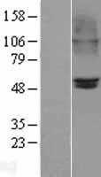 Nicotinic Acetylcholine Receptor beta 2(CHRNB2) (NM_000748) Human Tagged ORF Clone