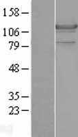 Hormone sensitive lipase(LIPE) (NM_005357) Human Tagged ORF Clone