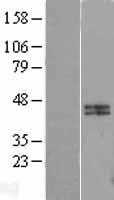 Calumenin(CALU) (NM_001219) Human Tagged ORF Clone