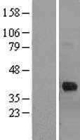 Cathepsin K(CTSK) (NM_000396) Human Tagged ORF Clone