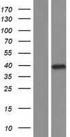 C6orf134(ATAT1) (NM_024909) Human Tagged ORF Clone