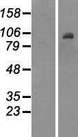 DNMT3B (NM_006892) Human Tagged ORF Clone