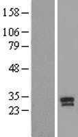 Prostate Specific Antigen(KLK3) (NM_001648) Human Tagged ORF Clone