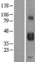 DLK(DLK1) (NM_003836) Human Tagged ORF Clone