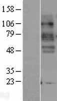 Serotonin transporter(SLC6A4) (NM_001045) Human Tagged ORF Clone