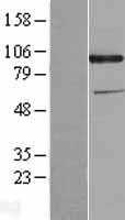 CDCP1 (NM_022842) Human Tagged ORF Clone