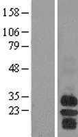 BAFF Receptor(TNFRSF13C) (NM_052945) Human Tagged ORF Clone