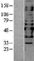 NAPRT1(NAPRT) (NM_145201) Human Tagged ORF Clone