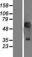 PAX2 (NM_003987) Human Tagged ORF Clone