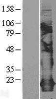 Claudin 5(CLDN5) (NM_003277) Human Tagged ORF Clone