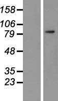PSMA(FOLH1) (NM_004476) Human Tagged ORF Clone