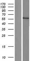 Cytochrome P450 17A1(CYP17A1) (NM_000102) Human Tagged ORF Clone