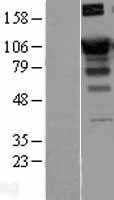 SATB1 (NM_002971) Human Tagged ORF Clone