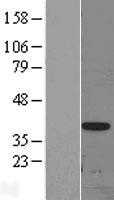 DLX3 (NM_005220) Human Tagged ORF Clone
