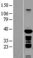 PSMC6 (NM_002806) Human Tagged ORF Clone