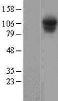 PSMD1 (NM_002807) Human Tagged ORF Clone