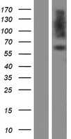 PDI(PDIA2) (NM_006849) Human Tagged ORF Clone