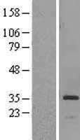HSD17B6 (NM_003725) Human Tagged ORF Clone