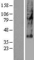 SLC46A3 (NM_181785) Human Tagged ORF Clone